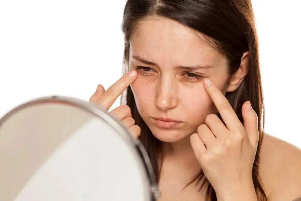 Yu-Be Skincare's tips: The MOST EFFECTIVE Ways for Getting Rid of Dark Under Eye Circles