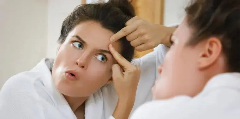 6 Acne Myths Busted: Why Popping Pimples Will Not Solve Your Acne Issues and Why