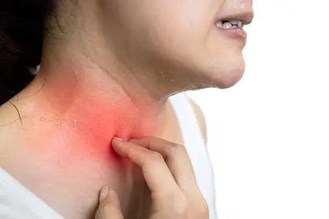Hot Weather Hacks: How to Prevent Eczema Flare-Ups This Summer
