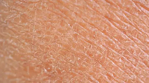 Yu-Be Skincare Blog: 9 Surprising Consequences of Not Moisturizing Enough That You Probably Don't Know