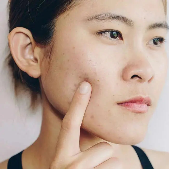5 Practical Tips for Keeping Your Skin Barrier Healthy & Strong