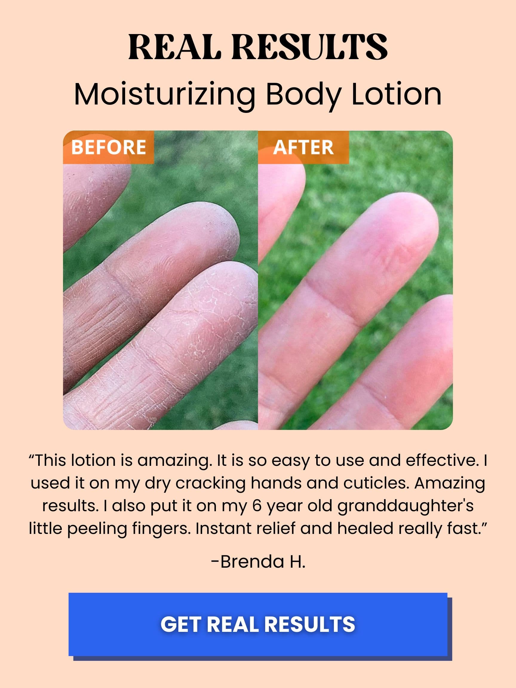 moisturizing body lotion for dry fingers