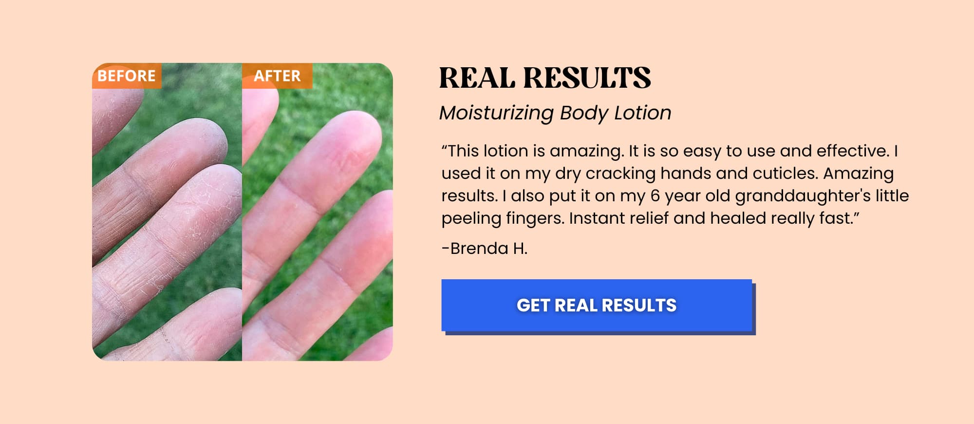 moisturizing body lotion for dry fingers