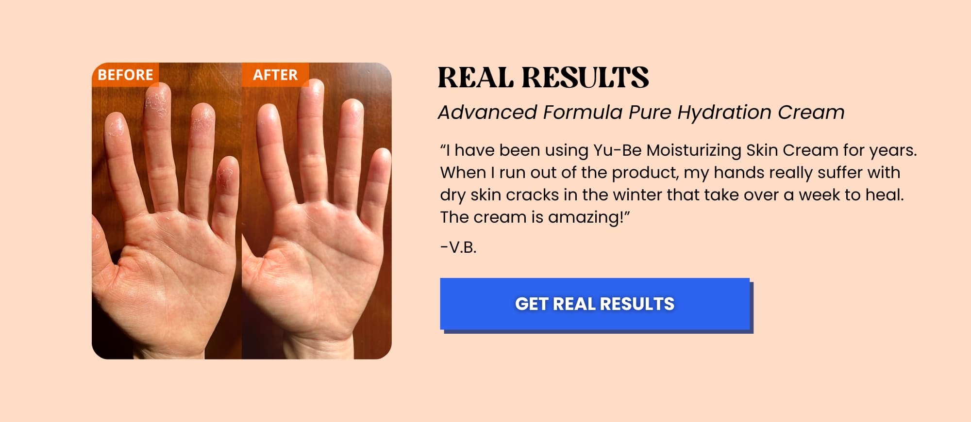 Advanced Formula Pure Hydration Cream for dry hands