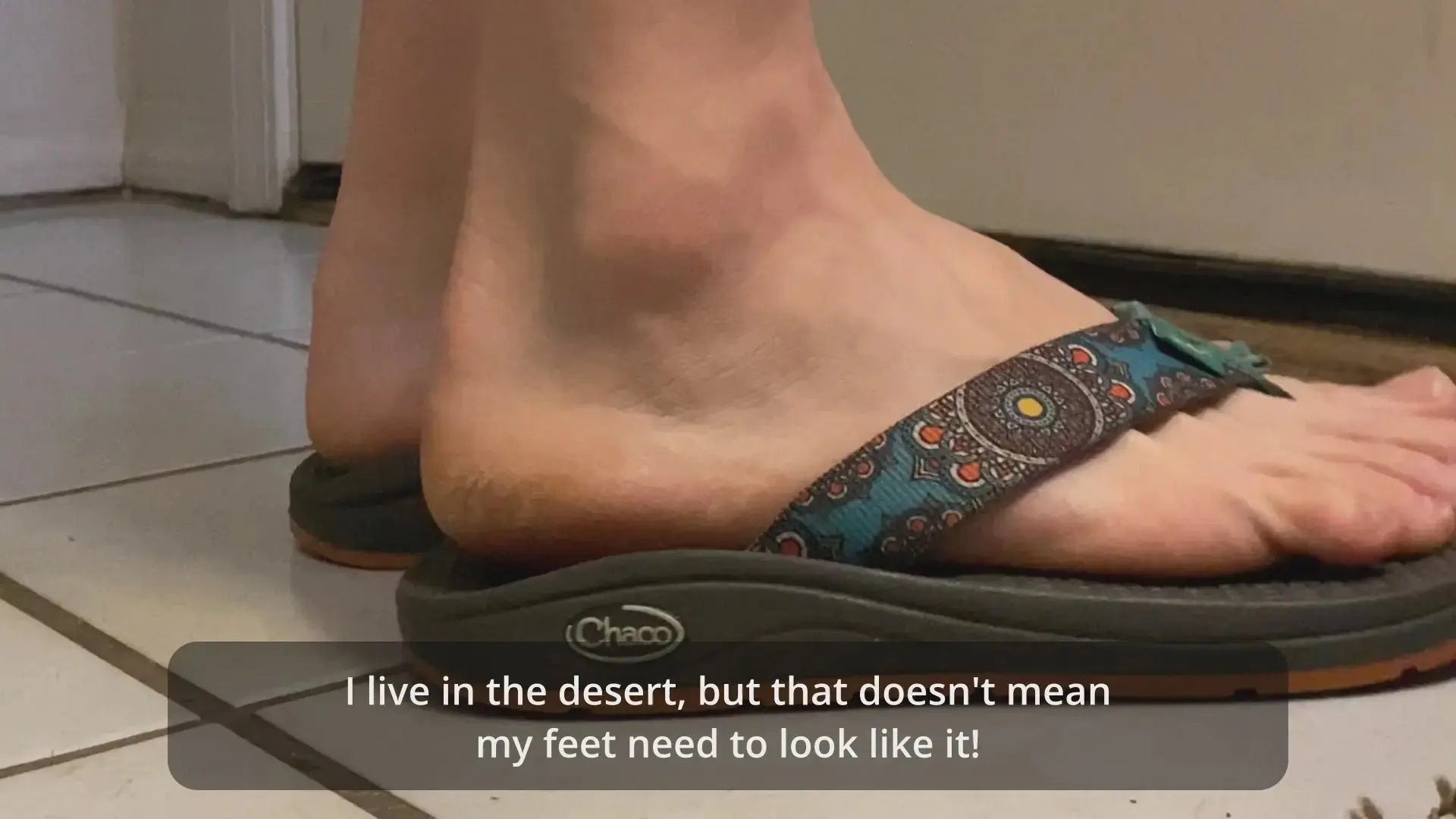 Video showing how the Yu-Be Heel & Elbow Moisturizing Socks get rid of dry, cracked heels and heels fast