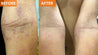 Moisturizing Skin Cream (SAVE 10%)